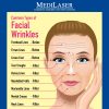 What you need to know about dermal fillers