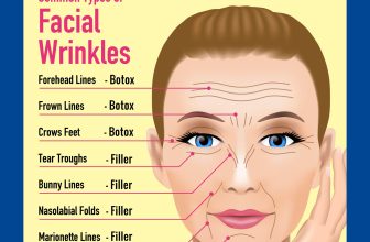 What you need to know about dermal fillers