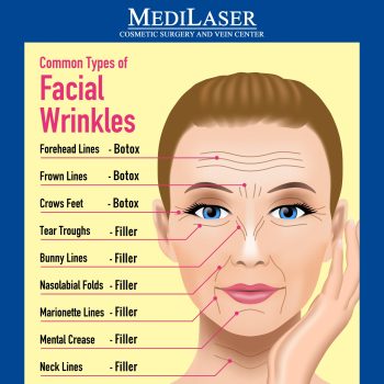 What you need to know about dermal fillers