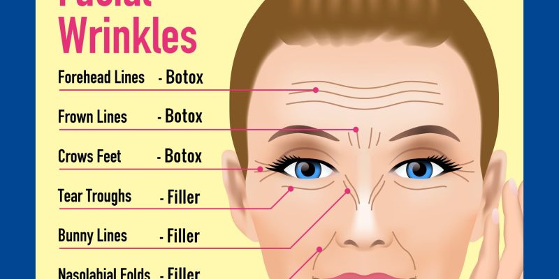 What you need to know about dermal fillers